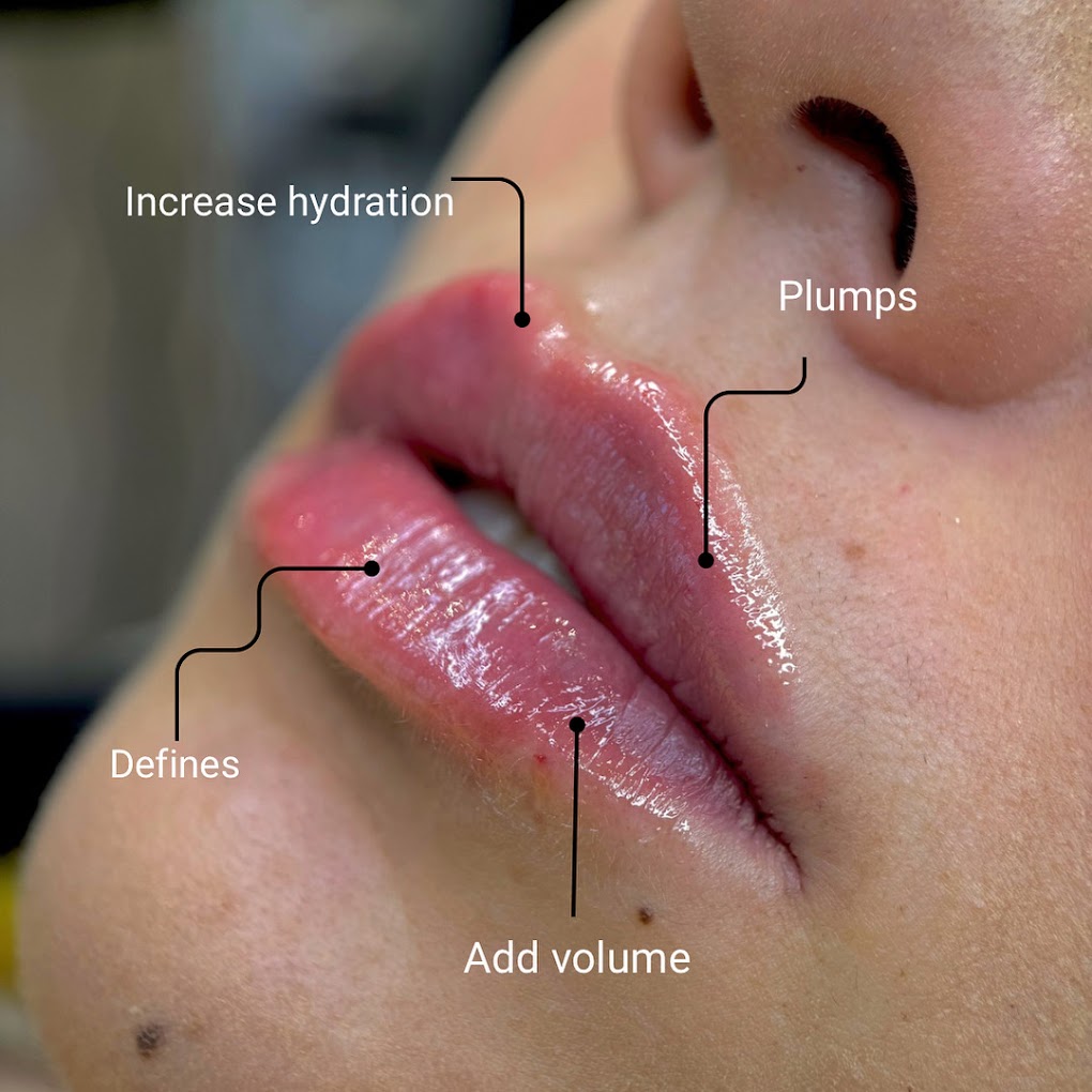 Lip Definition